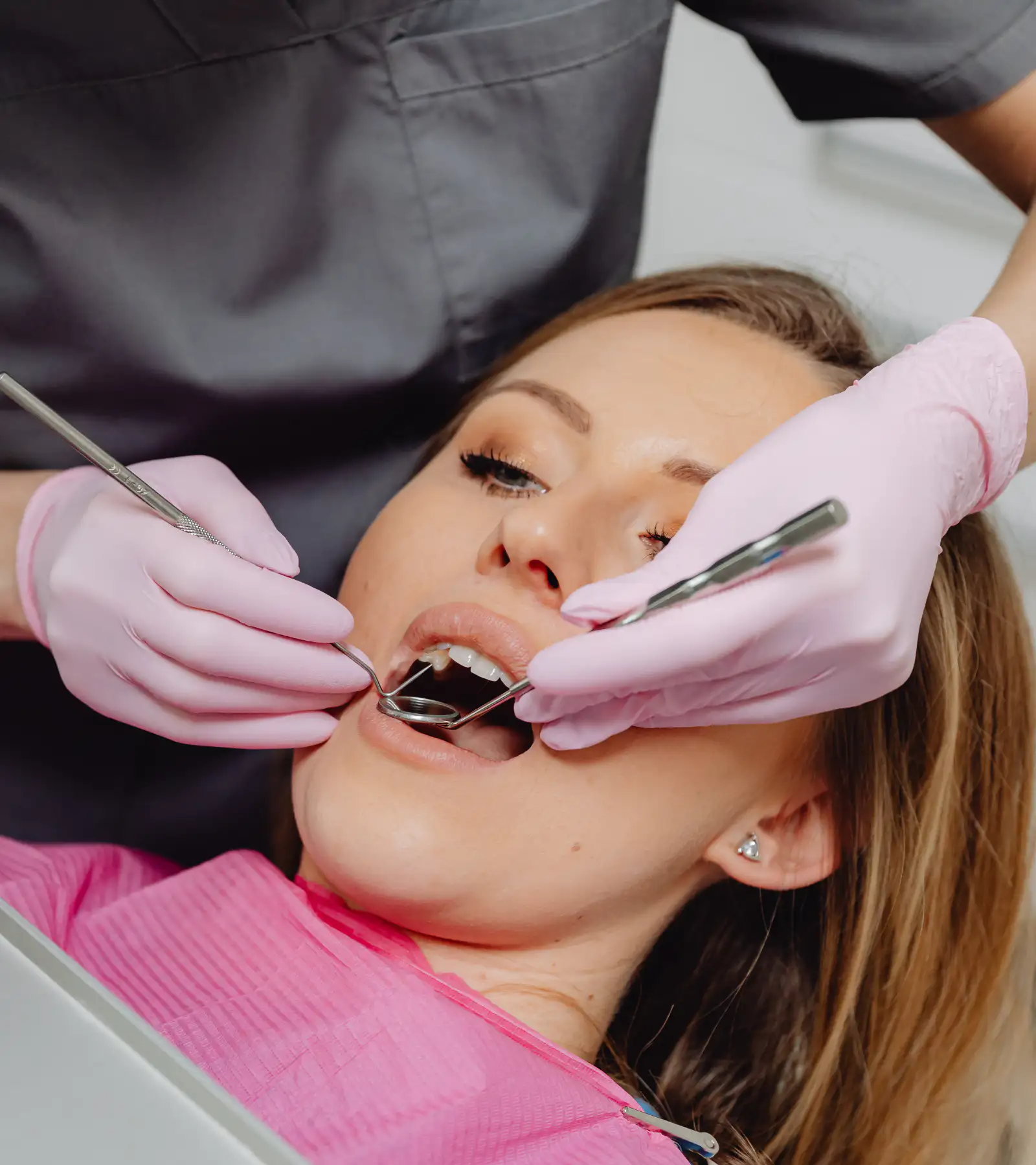 Teeth Bonding in Delray Beach