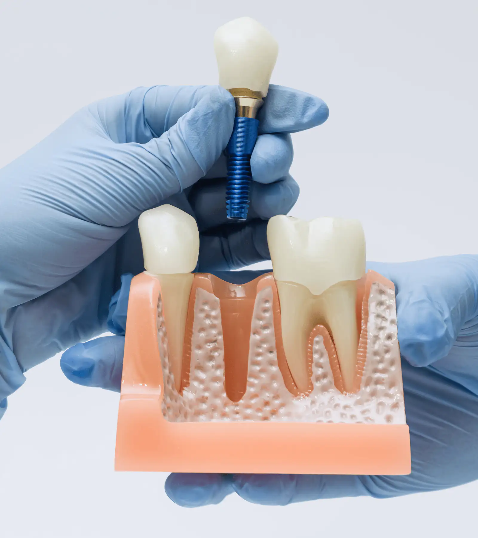 Revision Surgery in Delray Beach