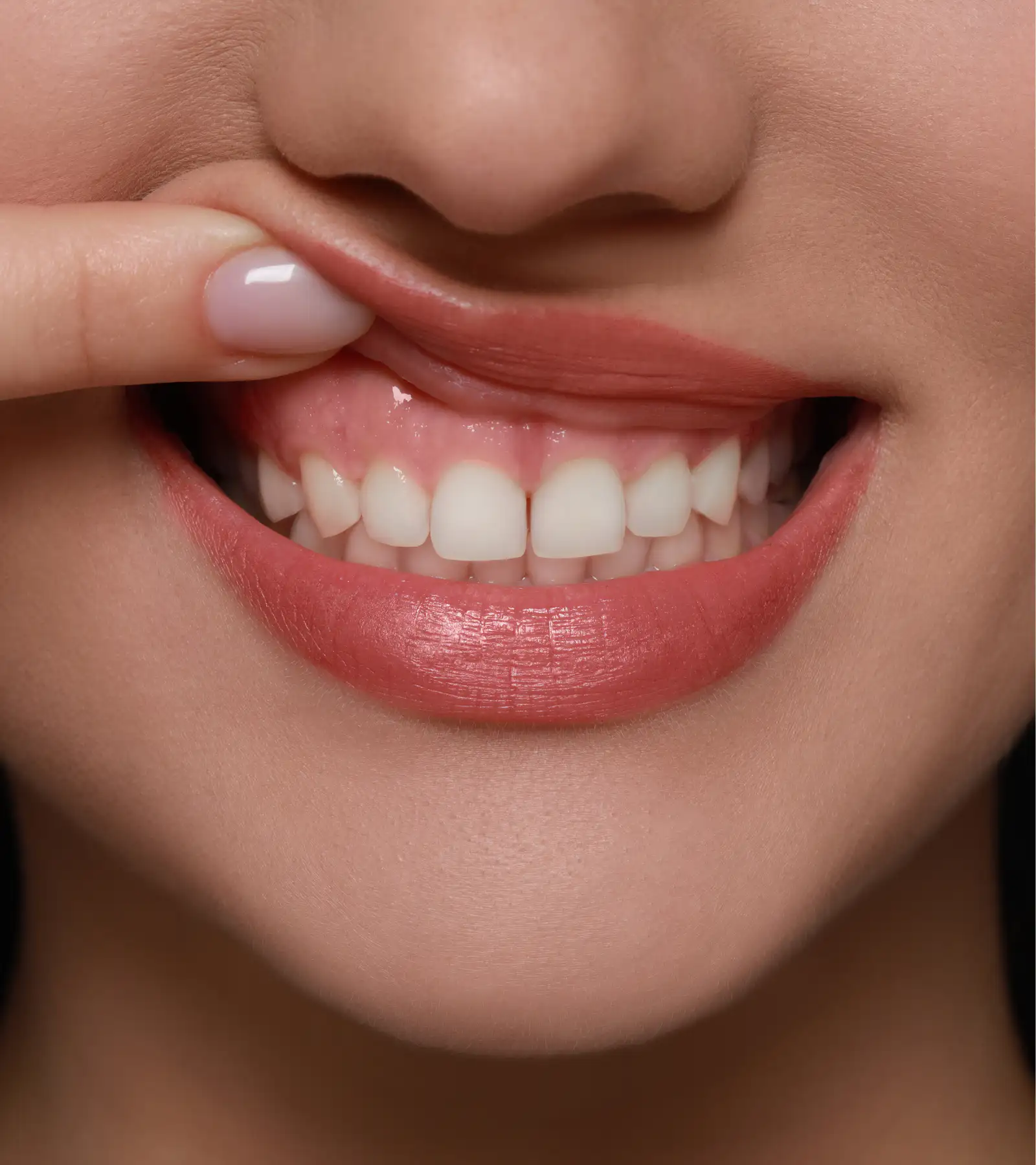 Gum Grafting in Delray Beach